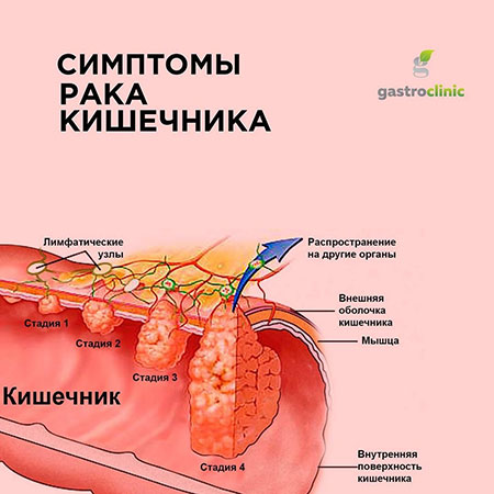 Гастроэнтеролог в Алматы